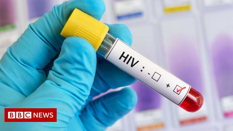 Scientists: A Woman Has Been Cured From HIV